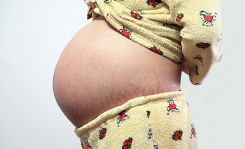 妊娠纹一般几个月开始长 怀孕为什么会长妊娠