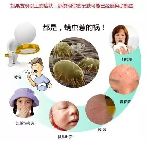 螨虫是一种肉眼不易看见的微型害虫