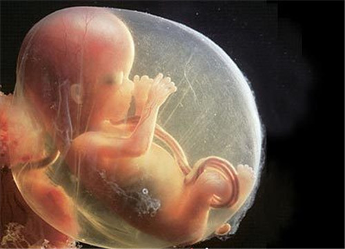四个月胎儿图片女孩图片