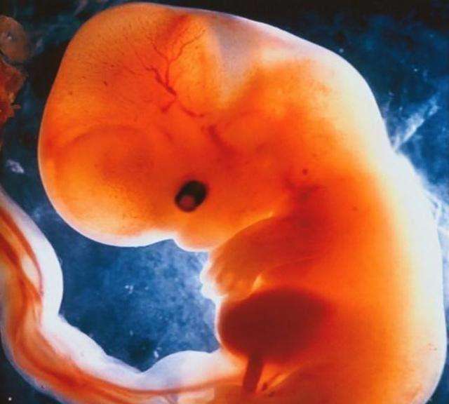 孕9周胎儿真实图图片